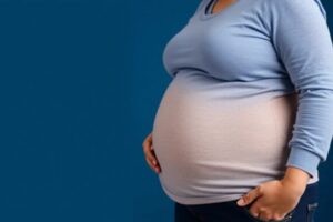 Obesidad y contratar un seguro de salud sin problemas